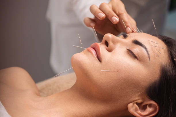 Acupuncture - A Great Deal extra Than Meets the Eyes