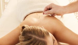 Pros and Cons of Acupuncture
