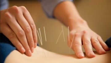How does acupuncture works - Acupuncture Magic