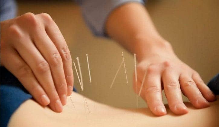 How does acupuncture work-Acupuncture Magic