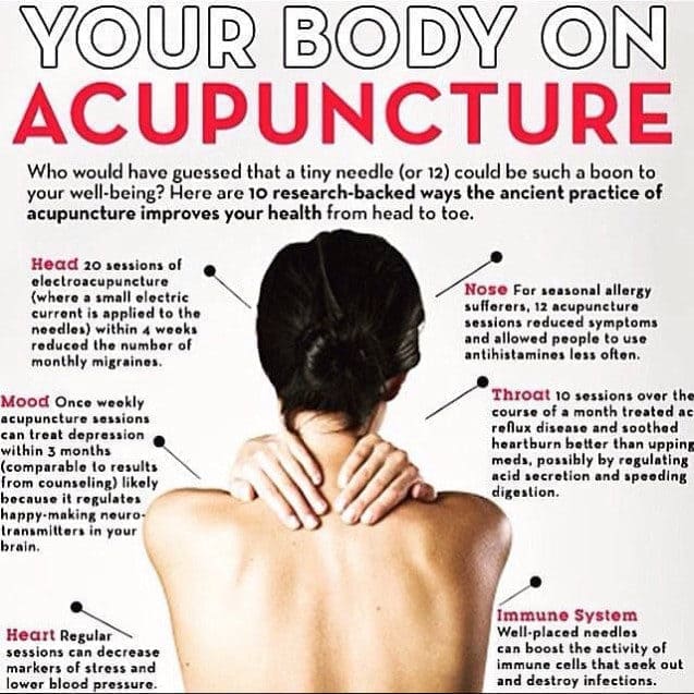 Acupuncture for Weight Loss