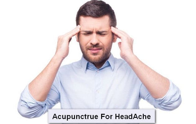 acupuncture for head ache