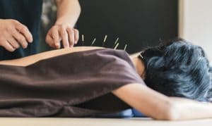 Pros and Cons of Acupuncture