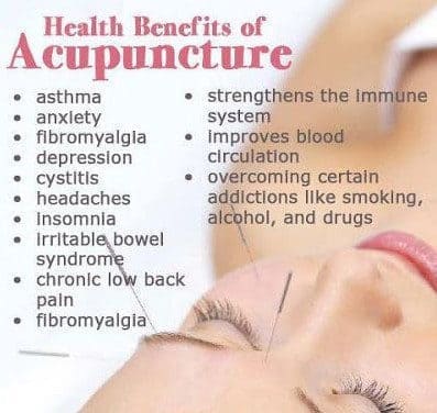 Acupuncture Treatment Benefits
