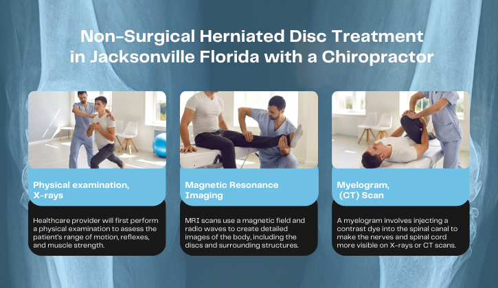 Non-Surgical Herniated Disc Treatment in Jacksonville Florida with a Chiropractor