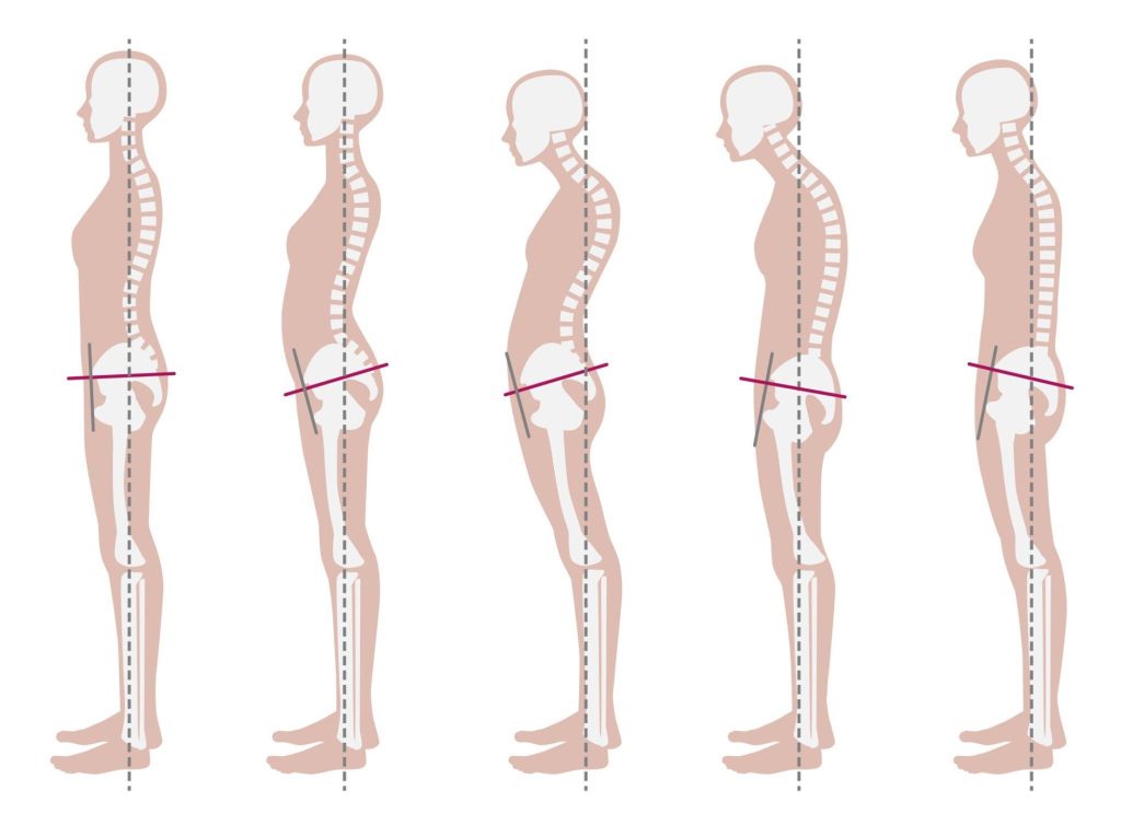 The Critical Role of Body Alignment in Everyday Life! 12 body alignment, body align, body alignment near me,