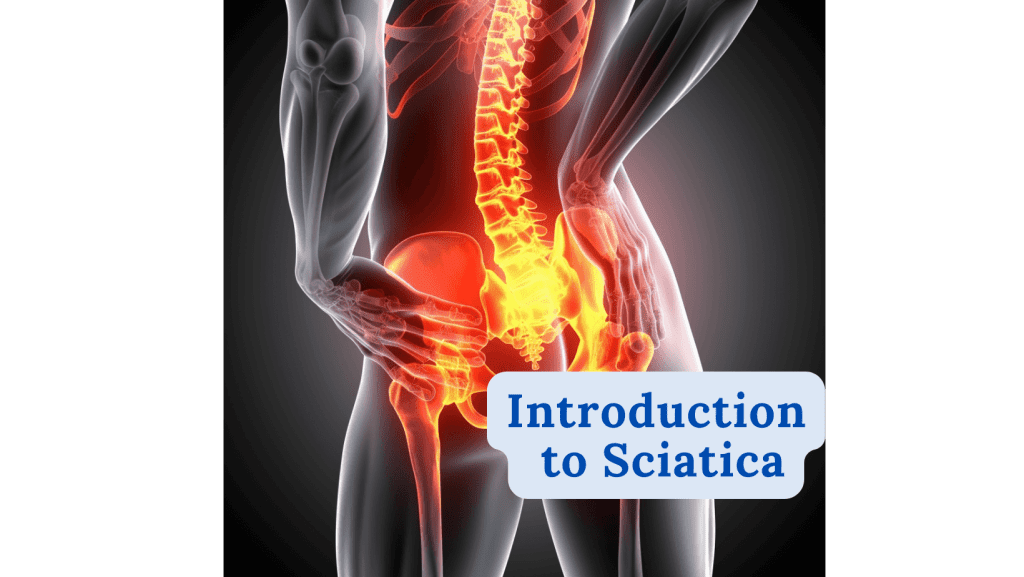 Curious about Sciatica 10 Introduction to Sciatica
