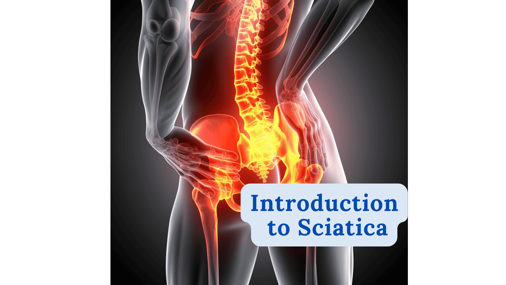 Introduction to Sciatica