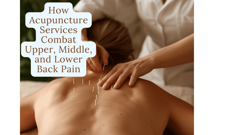 Unlocking Relief: How Jacksonville's Chiropractic and Acupuncture Services Combat Upper, Middle, and Lower Back Pain 4 How Acupuncture Services Combat Upper, Middle, and Lower Back Pain