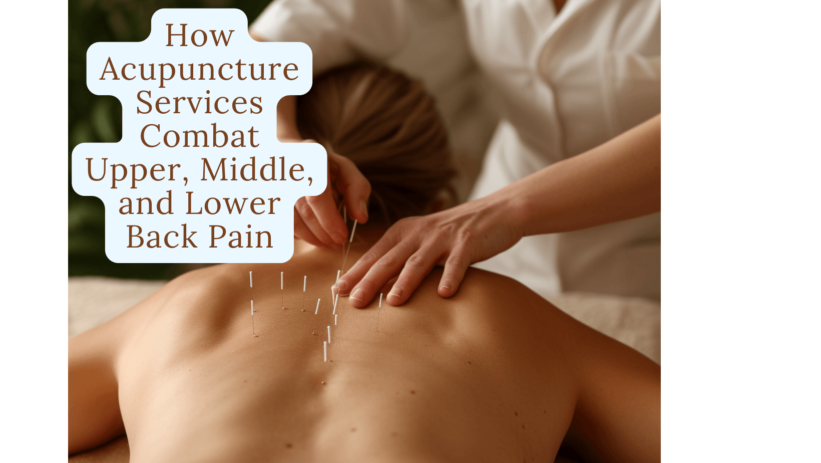 How Acupuncture Services Combat Upper, Middle, and Lower Back Pain